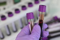 FDA одобрило революционное устройство для анализа крови, разработанное в Израиле