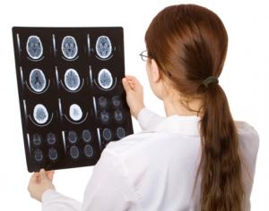 Лечение рака мозга в Израиле. Нейроонкология в Израиле