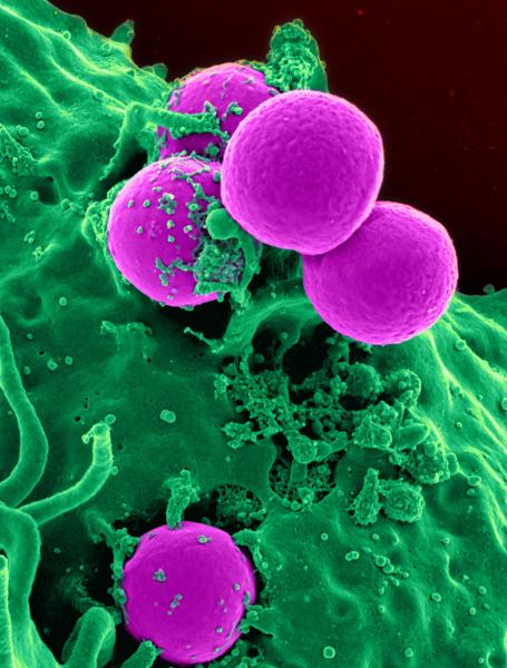 Израильское ученые синтезировали клетку, борющуюся с раком