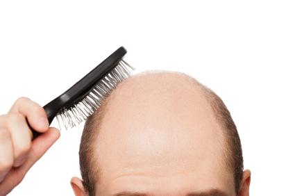 Эстетическая медицина. Когда внешний вид висит на волоске: что делать при выпадении волос и облысении?